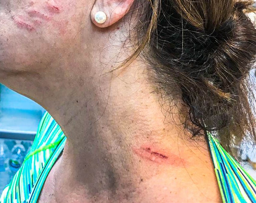 Mulher é ferida por drone após ser atingida dentro de um supermercado